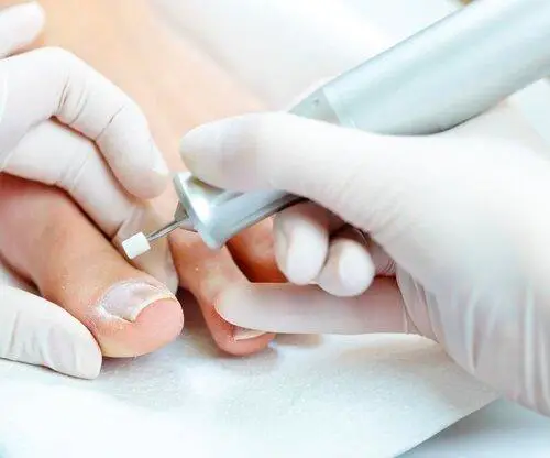 Medicinska osnovna pedikura